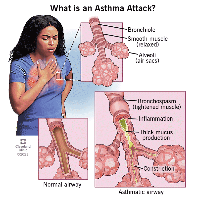 Cido Asthma Foundation